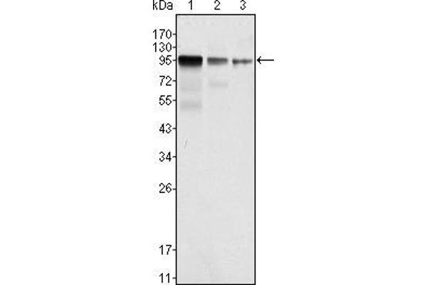 FER antibody