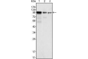 Western blot analysis using FER mouse mAb against NIH/3T3 (1), A549 (2) and SK-MEL-5 (3) cell lysate.