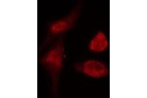 ABIN6274990 staining  COLO205 cells by IF/ICC. (CEP57 antibody  (Internal Region))