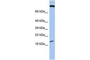 Image no. 1 for anti-Chromosome 5 Open Reading Frame 64 (C5ORF64) (AA 71-120) antibody (ABIN6743861) (C5ORF64 antibody  (AA 71-120))