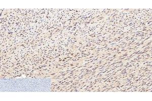 Immunohistochemistry of paraffin-embedded Human uterus tissue using Lamin B1 Monoclonal Antibody at dilution of 1:200. (Lamin B1 antibody)