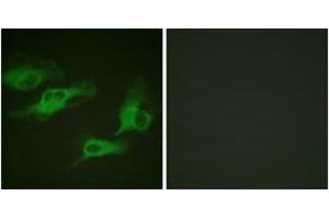 Immunofluorescence analysis of HeLa cells, using Adrenergic Receptor beta2 (Phospho-Ser346) Antibody. (beta 2 Adrenergic Receptor antibody  (pSer346))