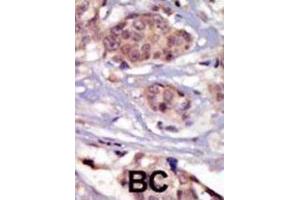 Immunohistochemistry (IHC) image for anti-FYN Oncogene Related To SRC, FGR, YES (FYN) antibody (ABIN3003445)