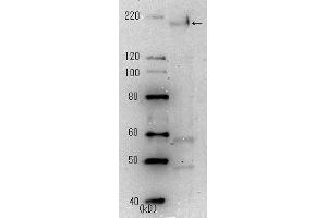 Western Blotting (WB) image for anti-SARS-Coronavirus Spike Protein (SARS-CoV S) antibody (ABIN2452119) (SARS-CoV Spike antibody)