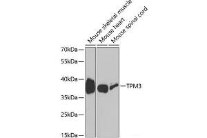 Western blot analysis of extracts of various cell lines using TPM3 Polyclonal Antibody at dilution of 1:1000. (TPM3 antibody)