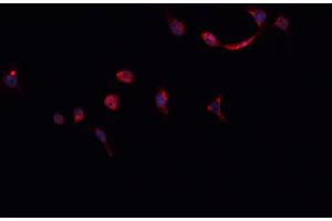 ABIN6268824 staining HeLa cells by IF/ICC. (HNRNPM antibody  (N-Term))