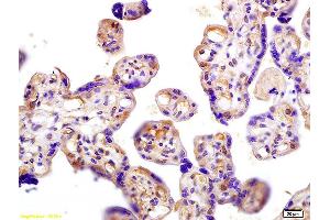 Formalin-fixed and paraffin embedded human placenta labeled with Anti Beta-HCG/HCG beta Polyclonal Antibody, Unconjugated (ABIN730243) at 1:200 followed by conjugation to the secondary antibody and DAB staining.