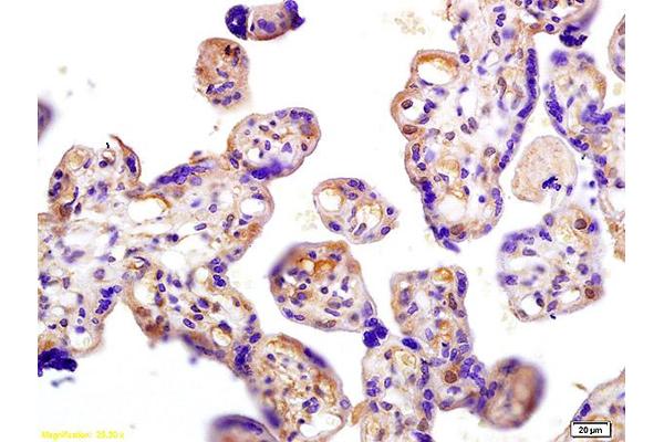 HCG beta antibody  (AA 81-165)
