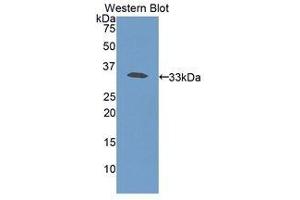 Western Blotting (WB) image for anti-Haptoglobin (HP) (AA 70-332) antibody (ABIN3207779) (Haptoglobin antibody  (AA 70-332))