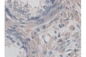 Immunohistochemistry (IHC) image for anti-CD209 (CD209) (AA 70-404) antibody (ABIN7444307)