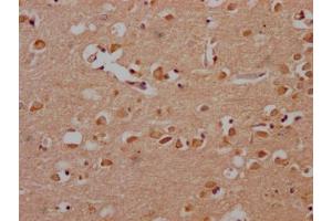IHC image of ABIN7166499 diluted at 1:200 and staining in paraffin-embedded human brain tissue performed on a Leica BondTM system. (Src antibody  (AA 2-100))