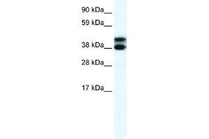 WB Suggested Anti-RFP2 Antibody Titration:  0. (TRIM13 antibody  (Middle Region))