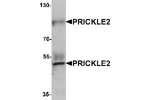 Western blot analysis of PRICKLE2 in A-20 lysate with PRICKLE2 antibody at 1 µg/mL.