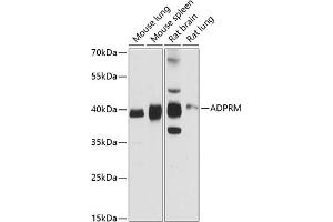 Western blot analysis of extracts of various cell lines, using ADPRM antibody (ABIN6131440, ABIN6136589, ABIN6136590 and ABIN6216678) at 1:3000 dilution. (ADPRM antibody  (AA 203-342))