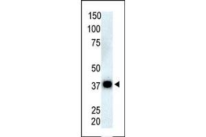 The anti-P6C Pab (ABIN392922 and ABIN2842296) is used in Western blot to detect P6C in Thymus cell lysate. (PPP6C antibody  (N-Term))