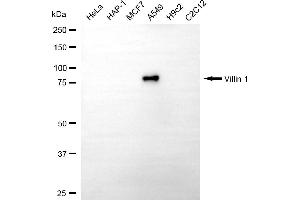 Western blotting analysis using villin 1 antibody (ABIN7800833).