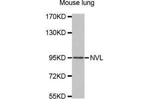 Western Blotting (WB) image for anti-Nuclear VCP-Like (NVL) antibody (ABIN1875763) (NVL antibody)