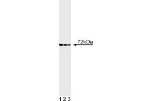 Western Blotting (WB) image for anti-IL2-Inducible T-Cell Kinase (ITK) (AA 1-26) antibody (ABIN967287) (ITK antibody  (AA 1-26))