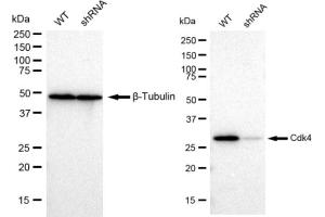Western blotting analysis using Cdk4 antibody (ABIN7798213). (Recombinant CDK4 antibody)