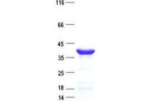 Validation with Western Blot (KCTD7 Protein (His tag))