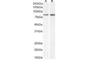 (ABIN7505831) (2 μg/mL) staining of A549 (A) and Caco-2 (B) cell lysate (35 μg protein in RIPA buffer). (Phospholipase C delta 3 antibody  (AA 261-274))