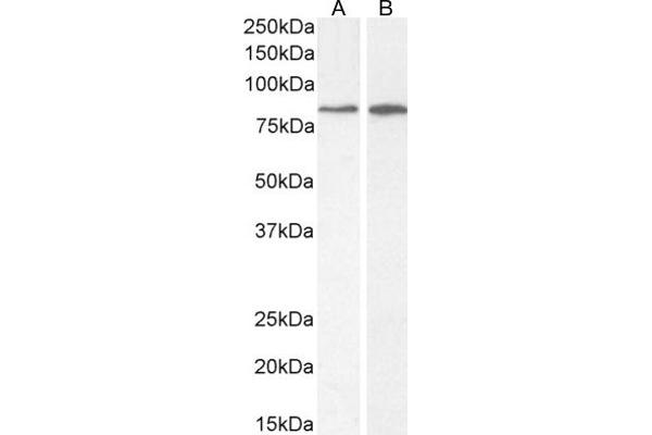 Phospholipase C delta 3 抗体  (AA 261-274)