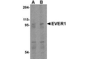 Western blot analysis of EVER1 in human spleen tissue lysate with AP30322PU-N EVER1 antibody at (A) 1 and (B) 2 μg/ml. (TMC6 antibody  (Center))