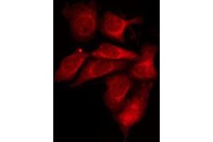 ABIN6275929 staining 293T by IF/ICC. (S1PR1 antibody  (Internal Region))