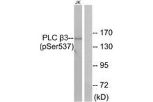 Western blot analysis of extracts from Jurkat cells treated with UV 15', using PLC beta3 (Phospho-Ser537) Antibody. (PLCB3 antibody  (pSer537))