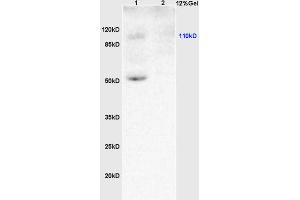 L1 rat brain lysates L2 human colon carcinoma lysates probed with Anti KLF5/UKHC Polyclonal Antibody, Unconjugated (ABIN739515) at 1:200 overnight at 4 °C. (KLF5 antibody  (AA 61-160))