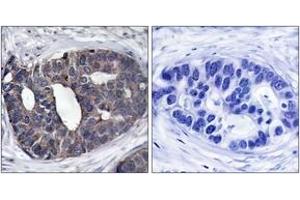 Immunohistochemistry (IHC) image for anti-Docking Protein 1, 62kDa (Downstream of tyrosine Kinase 1) (DOK1) (AA 329-378) antibody (ABIN1532846)