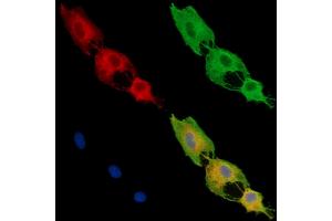 ABIN7096031 and ABIN7100093 staining  cells by IF/ICC. (DENND1A antibody)