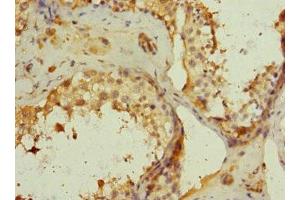 Immunohistochemistry of paraffin-embedded human testis tissue using ABIN7146098 at dilution of 1:100 (MRC2 antibody  (AA 120-300))