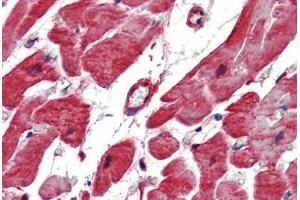 Human Heart (formalin-fixed, paraffin-embedded) stained with Heat Shock Protein 27 (HSP27) antibody ABIN462101 at 10 ug/ml followed by biotinylated goat anti-rabbit IgG secondary antibody ABIN481713, alkaline phosphatase-streptavidin and chromogen. (HSP27 antibody)