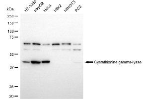 Western blotting analysis using cystathionine gamma-lyase antibody (ABIN7798234). (Recombinant CTH antibody)