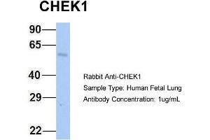 Host: Rabbit Target Name: CHEK1 Sample Type: Human Fetal Lung Antibody Dilution: 1. (CHEK1 antibody  (Middle Region))