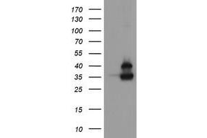 Image no. 1 for anti-OTU Domain, Ubiquitin Aldehyde Binding 1 (OTUB1) antibody (ABIN1499929) (OTUB1 antibody)