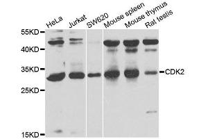 Western blot analysis of extracts of various cell lines, using CDK2 antibody. (CDK2 antibody)