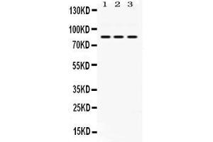 Western blot analysis of KRIT1 expression in rat cardiac muscle extract ( Lane 1), NIH3T3 whole cell lysates ( Lane 2) and HELA whole cell lysates ( Lane 3). (KRIT1 antibody  (C-Term))