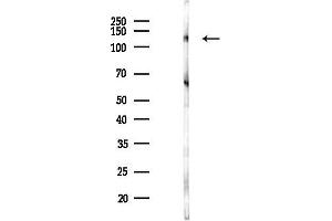 Western blot analysis of lysates from COLO205 cells(heat-shock,45 min treatment), using STON2 Antibody at 1/1000 dilution. (Stonin 2 (STON2) antibody)