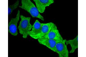 Immunofluorescence analysis of BT-20 cells using MCL1 antibody (ABIN4904325). (MCL-1 antibody)