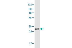 Western Blot detection against Immunogen (29. (UCP1 antibody  (AA 232-267))