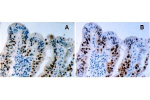 Immunohistochemistry (IHC) image for anti-Tumor Protein P53 (TP53) (AA 378-393), (pSer392) antibody (ABIN487475) (p53 antibody  (pSer392))