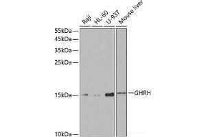Western blot analysis of extracts of various cell lines using GHRH Polyclonal Antibody at dilution of 1:1000. (GHRH antibody)