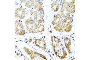 Immunohistochemistry of paraffin-embedded human stomach using PER1 antibody (ABIN5974860) at dilution of 1/100 (40x lens). (PER1 antibody)