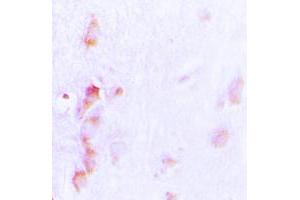Immunohistochemical analysis of CDCA3 staining in human brain formalin fixed paraffin embedded tissue section. (CDCA3 antibody  (C-Term))