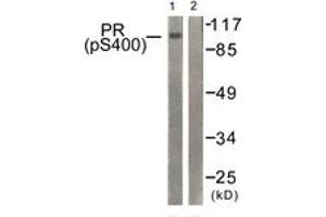 Western blot analysis of extracts from 293 cells treated with heat shock, using Progesterone Receptor (Phospho-Ser400) Antibody. (Progesterone Receptor antibody  (pSer400))