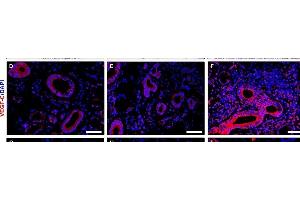 Increased expression of lymphangiogenic mediators in minor salivary glands (MSGs) from patients with primary Sjögren's syndrome (pSS). (VEGFC antibody  (AA 321-415))