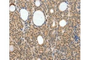 Immunohistochemistry (IHC) image for anti-Neurogenin 3 (NEUROG3) (AA 1-83) antibody (ABIN3016654) (Neurogenin 3 antibody  (AA 1-83))