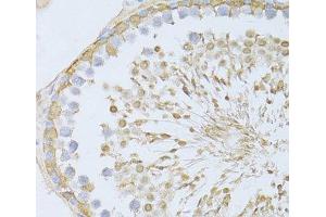 Immunohistochemistry of paraffin-embedded Rat testis using ENO3 Polyclonal Antibody at dilution of 1:100 (40x lens). (ENO3 antibody)